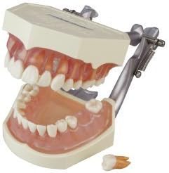 ニッシン　歯科模型　(I21d-KA3) 支台・窩洞形成模型歯 [A50/A50AN/A55ANシリーズ]｜株式会社